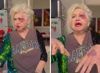 Wanna Marchi investita a Milano: "Sono devastata, ho rischiato la vita" Wanna Marchi investita a Milano: "Sono devastata, ho rischiato la vita"