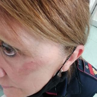 Vercelli, agente presa a calci in faccia da una donna durante controlli anticovid, Fsp Polizia: “Violenza sempre più arrogante, servono condanne severe”