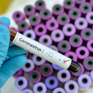 Coronavirus, nessun nuovo decesso nel Vercellese. In Piemonte 34 in un pomeriggio