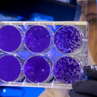 Coronavirus, bando in Piemonte per le assunzioni di personale all’ospedale di Verduno