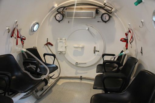 Vercelli: padre, madre e bimba intossicati dal monossido di carbonio Vercelli: padre, madre e bimba intossicati dal monossido di carbonio