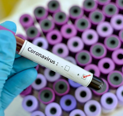 Coronavirus, le ultime 24 ore nel Vercellese e in Piemonte