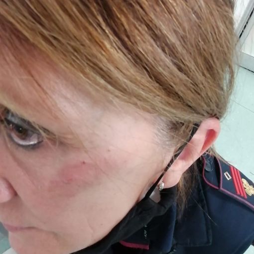 Vercelli, agente presa a calci in faccia da una donna durante controlli anticovid, Fsp Polizia: “Violenza sempre più arrogante, servono condanne severe”