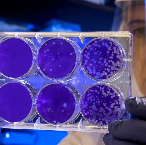 Coronavirus, 15 vercellesi guariti. Decessi fermi a 170