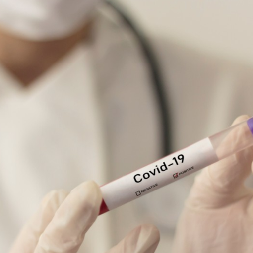 Coronavirus, 127 i nuovi contagi in Piemonte rispetto a ieri ma restano stabili