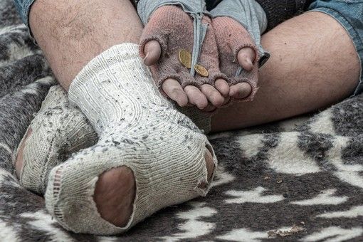 Senza dimora, nascono in Piemonte i &quot;tutor socio-sanitari&quot;.