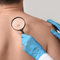 Giornata Europea del Melanoma: le linee guida per la prevenzione Giornata Europea del Melanoma: le linee guida per la prevenzione