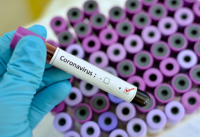 Coronavirus, le ultime 24 ore nel Vercellese e in Piemonte