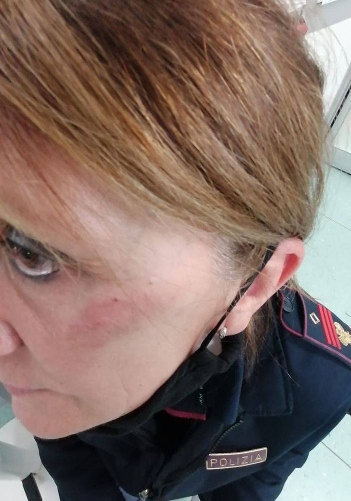 Vercelli, agente presa a calci in faccia da una donna durante controlli anticovid, Fsp Polizia: “Violenza sempre più arrogante, servono condanne severe”