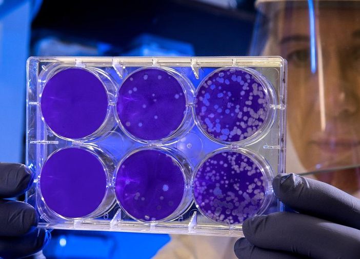 Coronavirus, bando in Piemonte per le assunzioni di personale all’ospedale di Verduno
