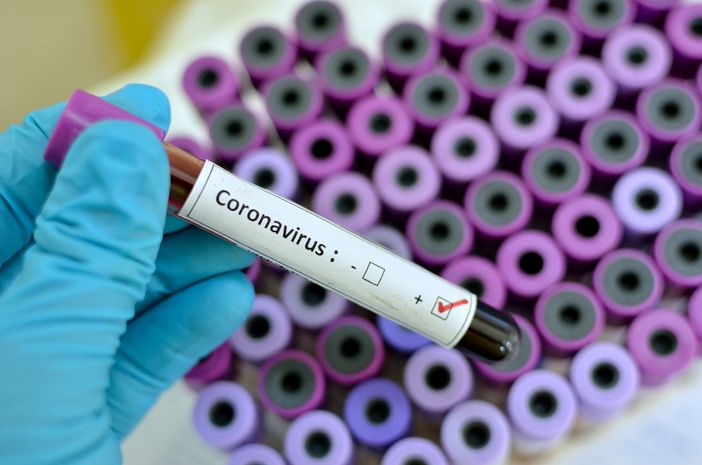 Coronavirus, in Piemonte 70 decessi in un giorno. Nel Vercellese un paziente deceduto Coronavirus, in Piemonte 70 decessi in un giorno. Nel Vercellese un paziente deceduto