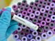 Coronavirus, le ultime 24 ore nel Vercellese e in Piemonte