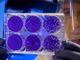 Coronavirus, 15 vercellesi guariti. Decessi fermi a 170