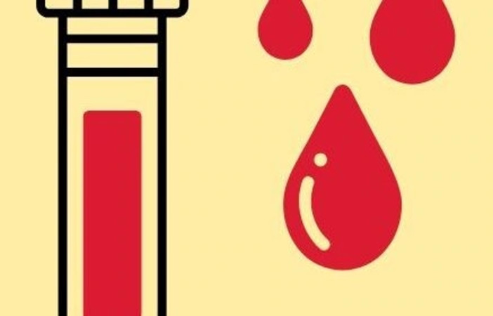 Esami del sangue solo su prenotazione nelle sedi ASL di Vercelli, Borgosesia e Gattinara