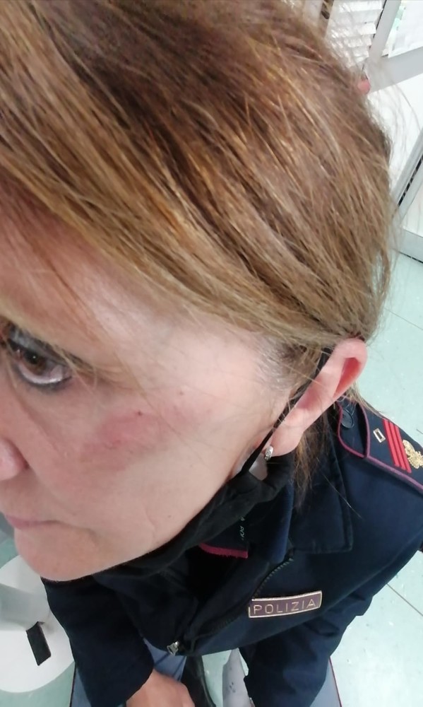 Vercelli, agente presa a calci in faccia da una donna durante controlli anticovid, Fsp Polizia: “Violenza sempre più arrogante, servono condanne severe”