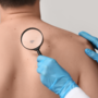 Giornata Europea del Melanoma: le linee guida per la prevenzione Giornata Europea del Melanoma: le linee guida per la prevenzione
