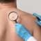 Giornata Europea del Melanoma: le linee guida per la prevenzione