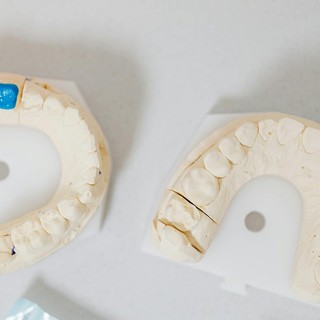 Le abitudini che danneggiano i denti: quali sono e come rimediare