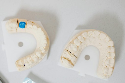 Le abitudini che danneggiano i denti: quali sono e come rimediare