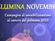 Borgosesia: Il Comune si veste di bianco per la campagna ALCASE Borgosesia: Il Comune si veste di bianco per la campagna ALCASE