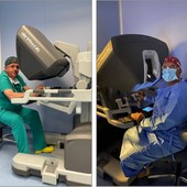 All’Ospedale Sant’Andrea di Vercelli 64 interventi con il robot Da Vinci tra Chirurgia generale e Urologia All’Ospedale Sant’Andrea di Vercelli 64 interventi con il robot Da Vinci tra Chirurgia generale e Urologia