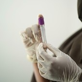 Hantavirus, la Regione invia la circolare del Ministero della Salute ad aziende sanitarie e personale medico (foto di repertorio)