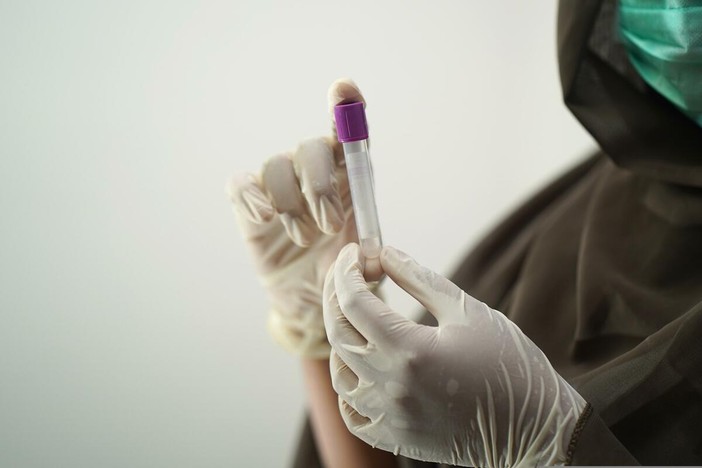 Hantavirus, la Regione invia la circolare del Ministero della Salute ad aziende sanitarie e personale medico (foto di repertorio)