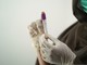 Hantavirus, la Regione invia la circolare del Ministero della Salute ad aziende sanitarie e personale medico (foto di repertorio)