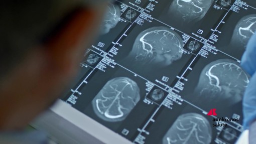 Fenilchetonuria, 'screening neonatale evita danni neurologici ma serve continuità assistenziale'