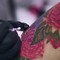 I tatuaggi fanno venire il melanoma? La risposta del dermatologo