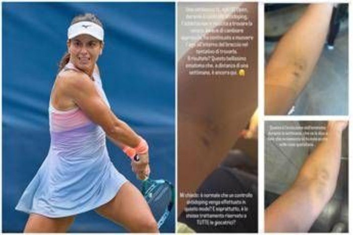 US Open, Stefanini e il livido sul braccio: "Colpa di un controllo antidoping..."