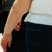 Una morte per malattie infettive su 10 è legata all'obesità, lo studio