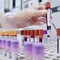 Hiv, dalla Sicilia il modello per estendere terapie long acting Hiv, dalla Sicilia il modello per estendere terapie long acting