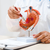 Cancro allo stomaco avanzato, nuova terapia riduce del 42% il rischio di morte ﻿