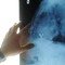 Radiologia interventistica, Ssn e fondazioni per cure più accessibili Radiologia interventistica, Ssn e fondazioni per cure più accessibili