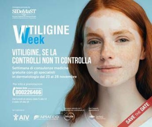 Vitiligine week, Sidemast: "Circa mille consulenze dermatologiche gratuite"