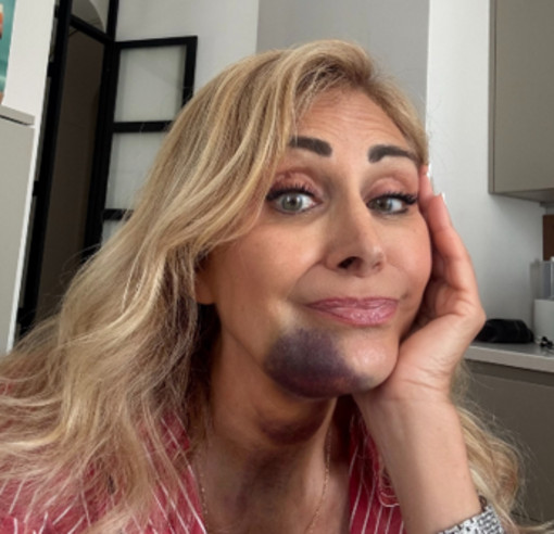 Marina Di Guardo, l'incidente in Sicilia con un trattore: il racconto sui social Marina Di Guardo, l'incidente in Sicilia con un trattore: il racconto sui social