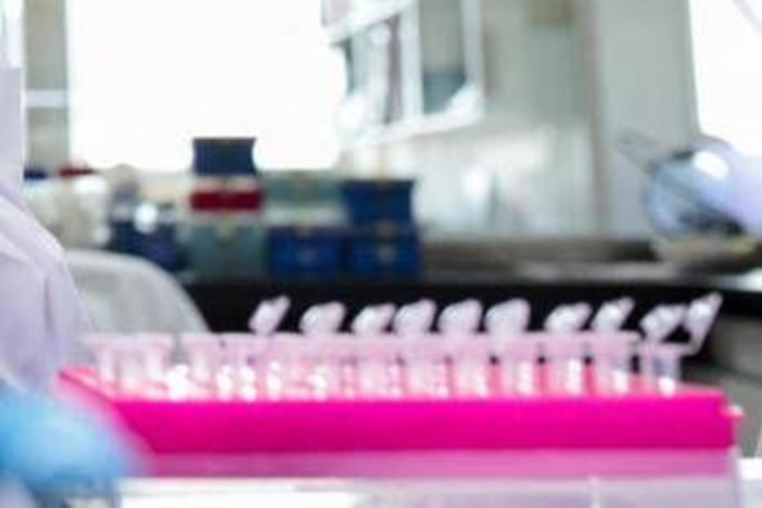 Milano, focolaio di tubercolosi all'Istituto di Medicina legale: 8 casi conclamati e 7 positivi. Indagini sull'origine del contagio