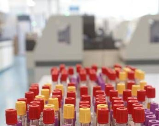 Cos'è il batterio mangiacarne sotto la lente a Messina, minaccia in crescita per il caldo record