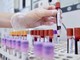 Dal microbiota una speranza contro l'epilessia resistente, lo studio italiano