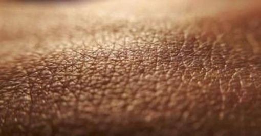 Dermatite atopica, quando la pelle condiziona la vita, 'Diari atipici' dà voce ai pazienti Dermatite atopica, quando la pelle condiziona la vita, 'Diari atipici' dà voce ai pazienti