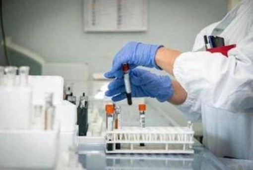 Medicina di laboratorio, Sibioc: "In Lombardia donne in 52% ruoli apicali un modello"