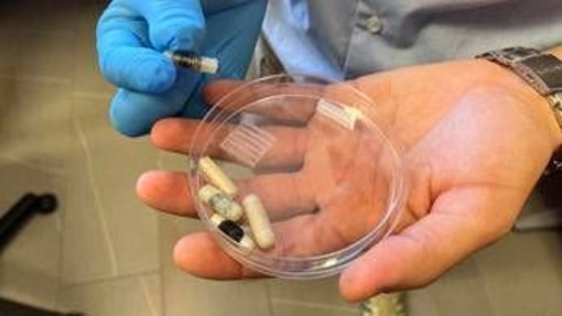 Una capsula-cerotto per guarire le ulcere intestinali: ecco come funziona