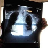 Sirm: "Ai strumento anti liste d'attesa, 50% esami imaging per over70 non necessario" Sirm: "Ai strumento anti liste d'attesa, 50% esami imaging per over70 non necessario"
