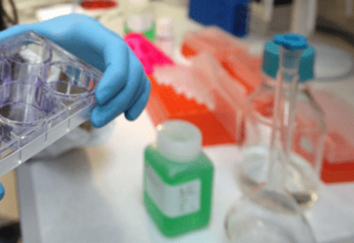 Tumori, al via studio per ridurre rischio recidive da cancro al seno Tumori, al via studio per ridurre rischio recidive da cancro al seno