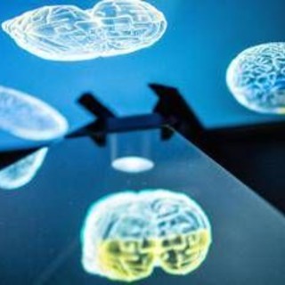 Ictus, ecco come l'emisfero sano del cervello influenza la ripresa: la ricerca rivoluzionaria