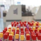 Cos'è il batterio mangiacarne sotto la lente a Messina, minaccia in crescita per il caldo record Cos'è il batterio mangiacarne sotto la lente a Messina, minaccia in crescita per il caldo record