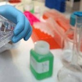 Colite ulcerosa, nuovi dati dallo studio Verdict su vedolizumab Colite ulcerosa, nuovi dati dallo studio Verdict su vedolizumab