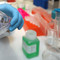 Tumori, al via studio per ridurre rischio recidive da cancro al seno Tumori, al via studio per ridurre rischio recidive da cancro al seno