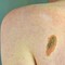 Melanoma, Adoi: "Bene nuova legge su prevenzione, dermatologo centrale in screening" Melanoma, Adoi: "Bene nuova legge su prevenzione, dermatologo centrale in screening"